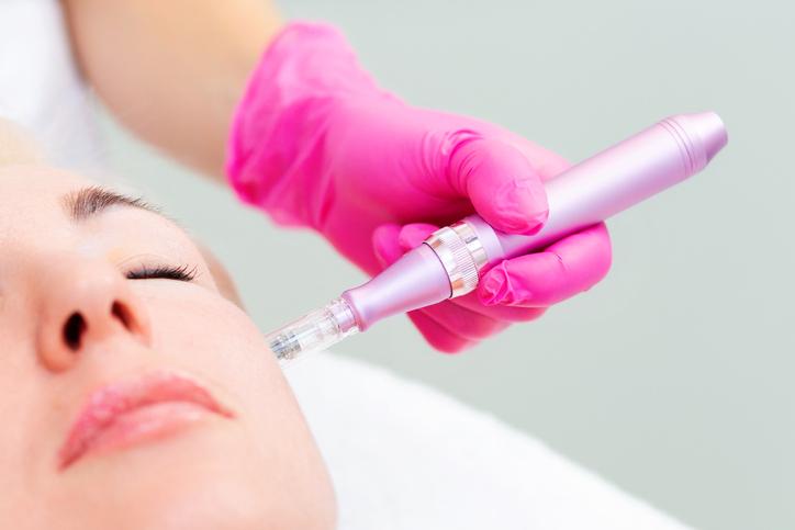 Microneedle Treatments with skin growth Factors