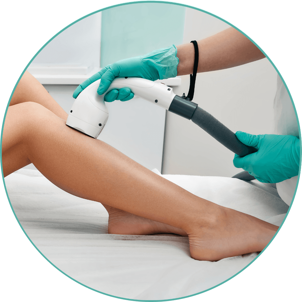 Laser Hair Removal - Legs